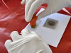 Microscopic Examination of Feces