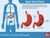 Method of Gastric Analysis