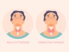 Disorders of Thyroid Gland: Hypothyroidism & Hyperthyroidism