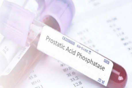 Acid Phosphatase (AP): Total and Prostatic Acid Phosphatase.