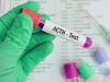 Adrenocorticotropic Hormone (ACTH)