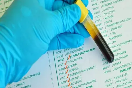 Serum albumin test.