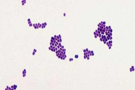 Clusters of Gram-positive bacteria.