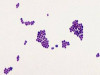 Gram Staining: Purpose, Principle, Procedure and Observation
