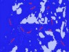 Acid-Fast Staining: Purpose, Principle, Procedure and Observation