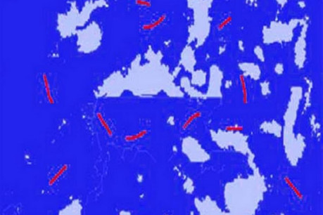 Sputum smear stained with Ziehl-Neelsen stain showing acid-fast bacilli.