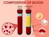 Macro Method (Wintrobe Method) for Estimation of Packed Cell Volume (PCV) or Hematocrit (HCT)