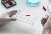 Determination of Blood Group by Slide Method