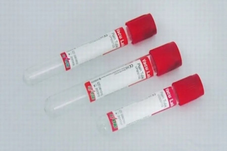 Blood collection tubes