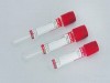 Plain Tubes (Without Any Anticoagulant) and Fluoride Tubes for Collection of Blood
