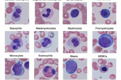White Blood Cells Morphology