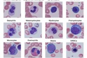White Blood Cells Morphology