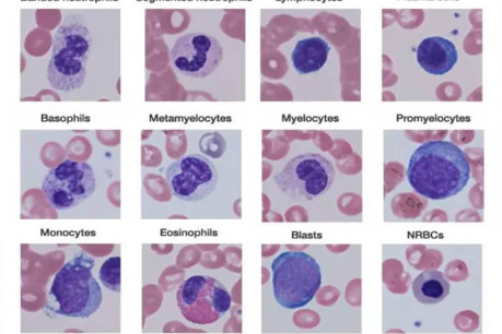 Different Types of Leukocytes
