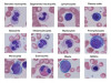 White Blood Cells Morphology