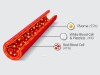 Morphology of Platelets