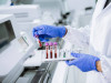 Causes of Erroneous Results (Interferences Causing Abnormal Result) With Hematology Analyzer