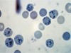 Reticulocyte