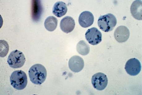Reticulocytes