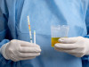 Lindeman’s Test for Ketone Bodies: Principle, Procedure, and Interpretation