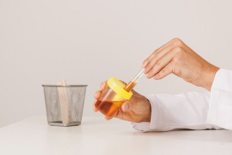 Urine Specimen for Acetest Tablet Test for Ketone Bodies