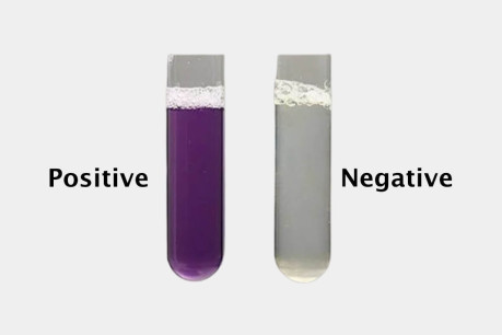 Biuret Test Reaction