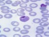 May Grünwald-Giemsa Stain: Principle, Procedure, and Protocol