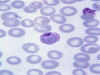May Grünwald-Giemsa Stain: Principle, Procedure, and Protocol