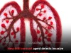 New MRI Breakthrough Can Detect Tiny Lung Tumors Before They Spread