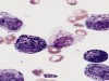 Sudan Black B Stain: Purpose, Principle, Procedure, and Interpretation