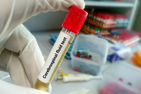 Cerebrospinal Fluid
