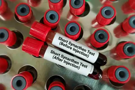 Synacthen Test