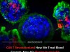 New GPNMB Target Gives CAR T Cells a One Two Punch Against Solid Tumors