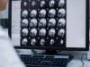 Scientists Uncover a Hidden Alzheimer’s Molecule That Silently Steals Memory Years Before Plaques Appear