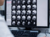 Scientists Uncover a Hidden Alzheimer’s Molecule That Silently Steals Memory Years Before Plaques Appear