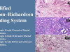 Modified Bloom–Richardson Grading System: Histological Basis, Scoring Criteria, and Clinical Significance