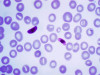 Detection of Nucleic Acid Sequences of Malaria Parasites