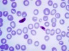 Detection of Nucleic Acid Sequences of Malaria Parasites