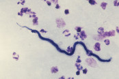 Microscopic Examination of Blood for Demonstration of Microfilaria