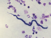 Microscopic Examination of Blood for Demonstration of Microfilaria