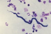 Microscopic Examination of Blood for Demonstration of Microfilaria