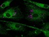 Scientists Find Method to “Recharge” Aging Cells Using Nanoflowers