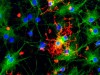 Bacterial Toxins Can Trigger Prion Like Brain Damage, Study Finds