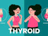 TSH Assay Generations: How Thyroid Testing Became More Precise Over Time