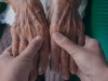 A Strong Daily Body Clock May Be One of the Most Powerful Ways to Lower Dementia Risk