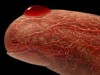 Blood Drop