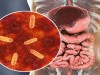 Scientists Find This Bacterial Protein for Faster Intestinal Healing