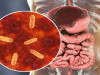 Scientists Find This Bacterial Protein for Faster Intestinal Healing