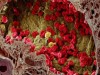 Scientists Have Finally Figured Out How Cancer Spreads Through the Bloodstream