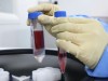 Only One Blood Type Link to Disease Confirmed in Large Scale Review