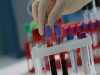 Contamination of Laboratory Equipment with Bloodborne Pathogens